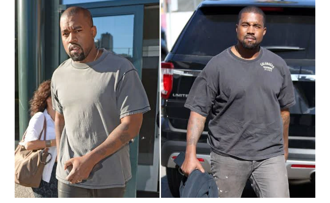 Kanye West And 4 Other Male Celebrities who did Plastic Surgery (before and after pics)